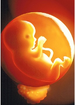 Foetus