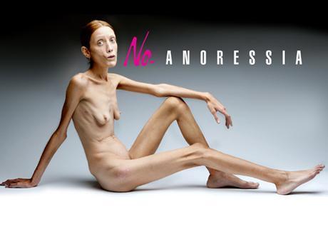Campagne contre l'anorexie présentée comme modèle